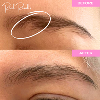 power serum